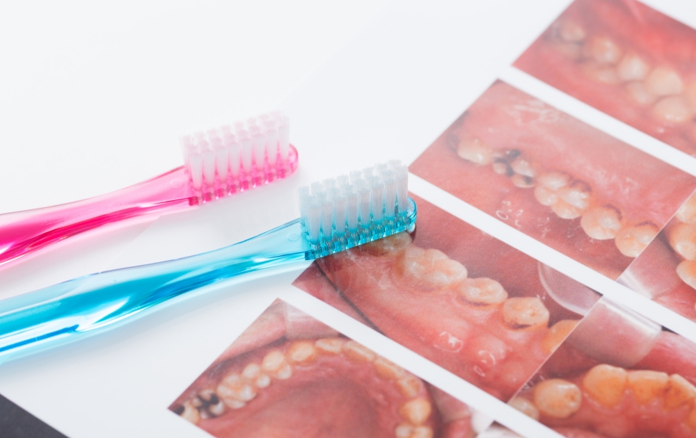 ① 歯ブラシのチェック