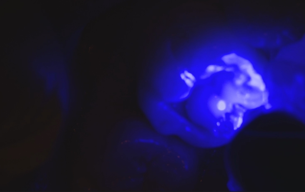 8.充填したプラスチックに光を当てて硬化させます。専用の光照射器で固め、強度を持たせます。