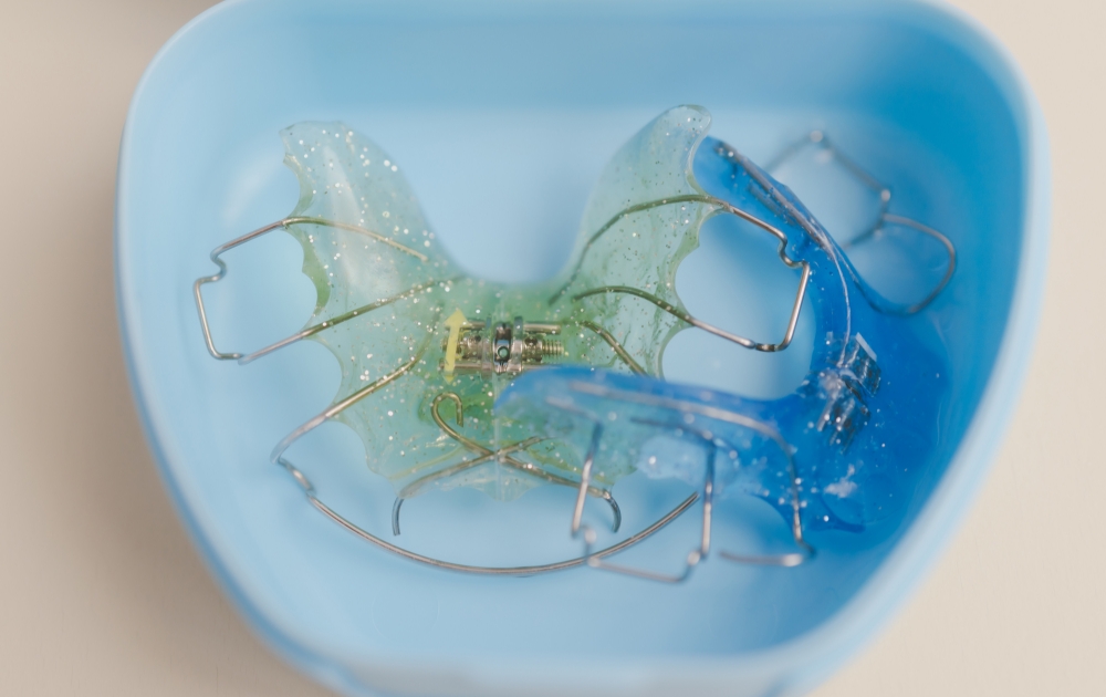 顎顔面矯正とは？